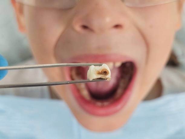 Best Emergency Dental Care for Sports Injuries in Berryville, AR